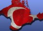 Россия-Турция: «битва» за туристов
